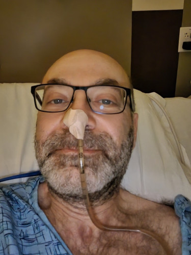 selfie, post op in hospital gown. Tube in my nose.